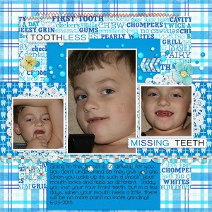 POST6-23-15frontteeth