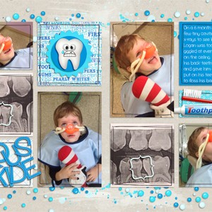 Cavities
