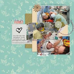 Azure-lee C-Section