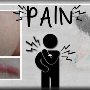 PAIN