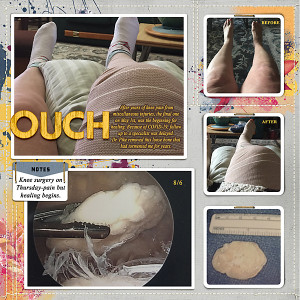 17-week-21-8-6-Thursday-knee-surgery-copy