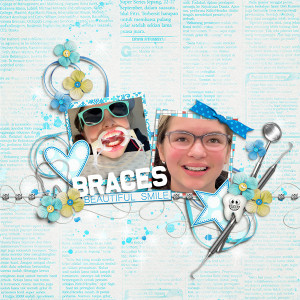 MOC12 12 - Everything Connected: Braces
