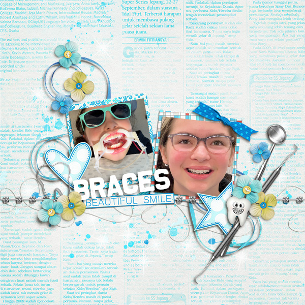 MOC12 12 - Everything Connected: Braces