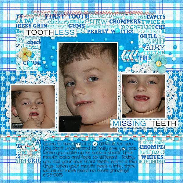 POST6-23-15frontteeth